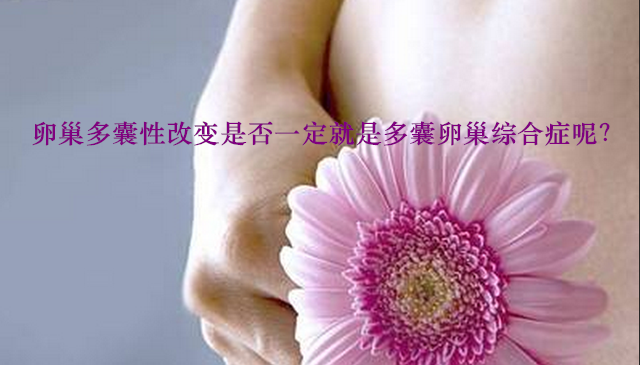 卵巢多囊性改变是否一定就是多囊卵巢综合症呢？